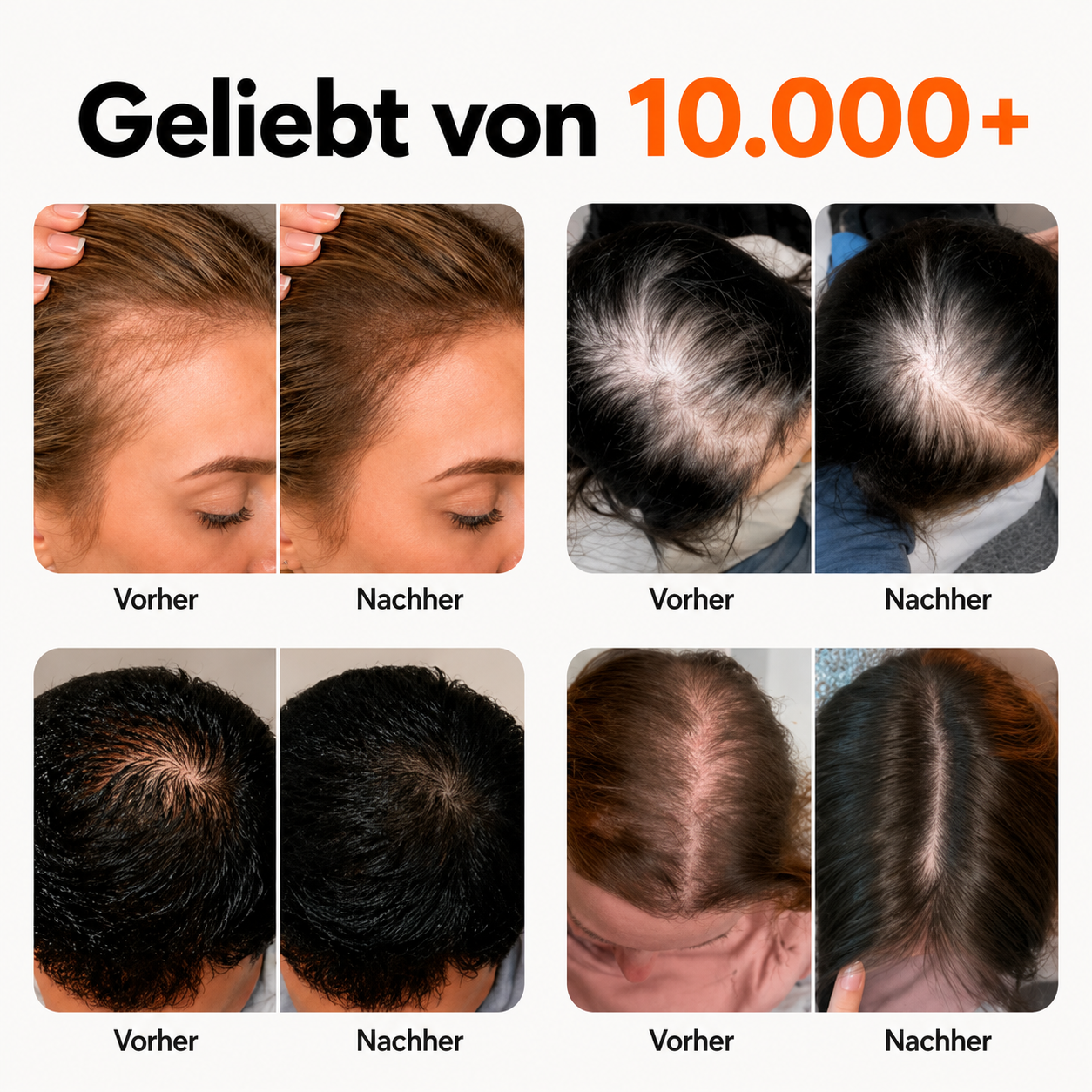 Folivexa™ - Haarserum mit Massage-Applikator