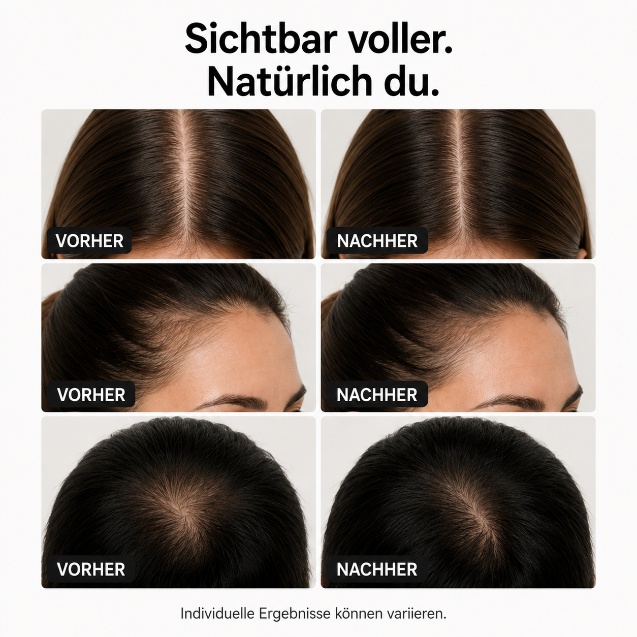 Folivexa™ - Haarserum mit Massage-Applikator